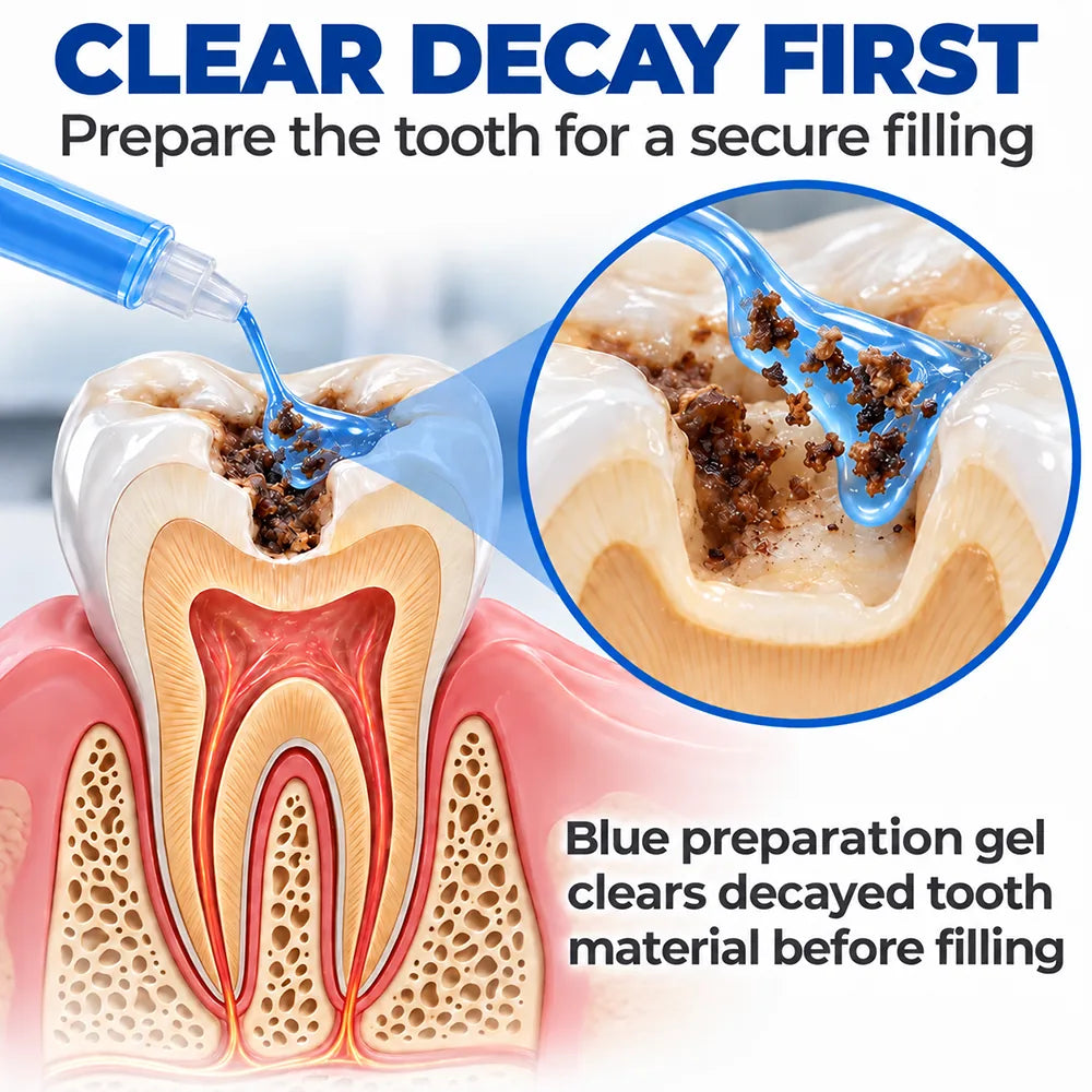 Dr.Fachmer® DentRestore Tooth Repair & Filling System 🌼