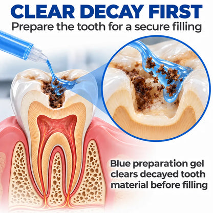 Dr.Fachmer® DentRestore Tooth Repair & Filling System 🌼
