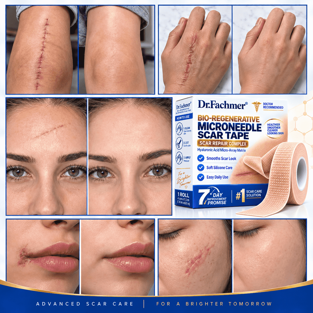 Dr.Fachmer® Bio-Regenerative Microneedle Scar Tape 🍀