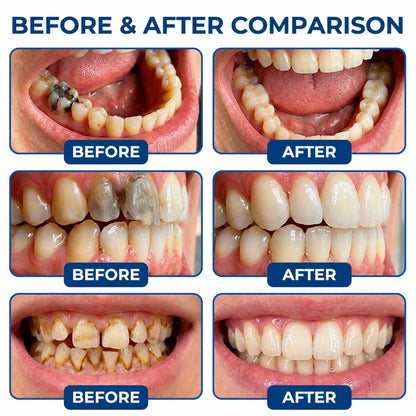 Dr.Fachmer® DentRestore Tooth Repair & Filling System 🌼
