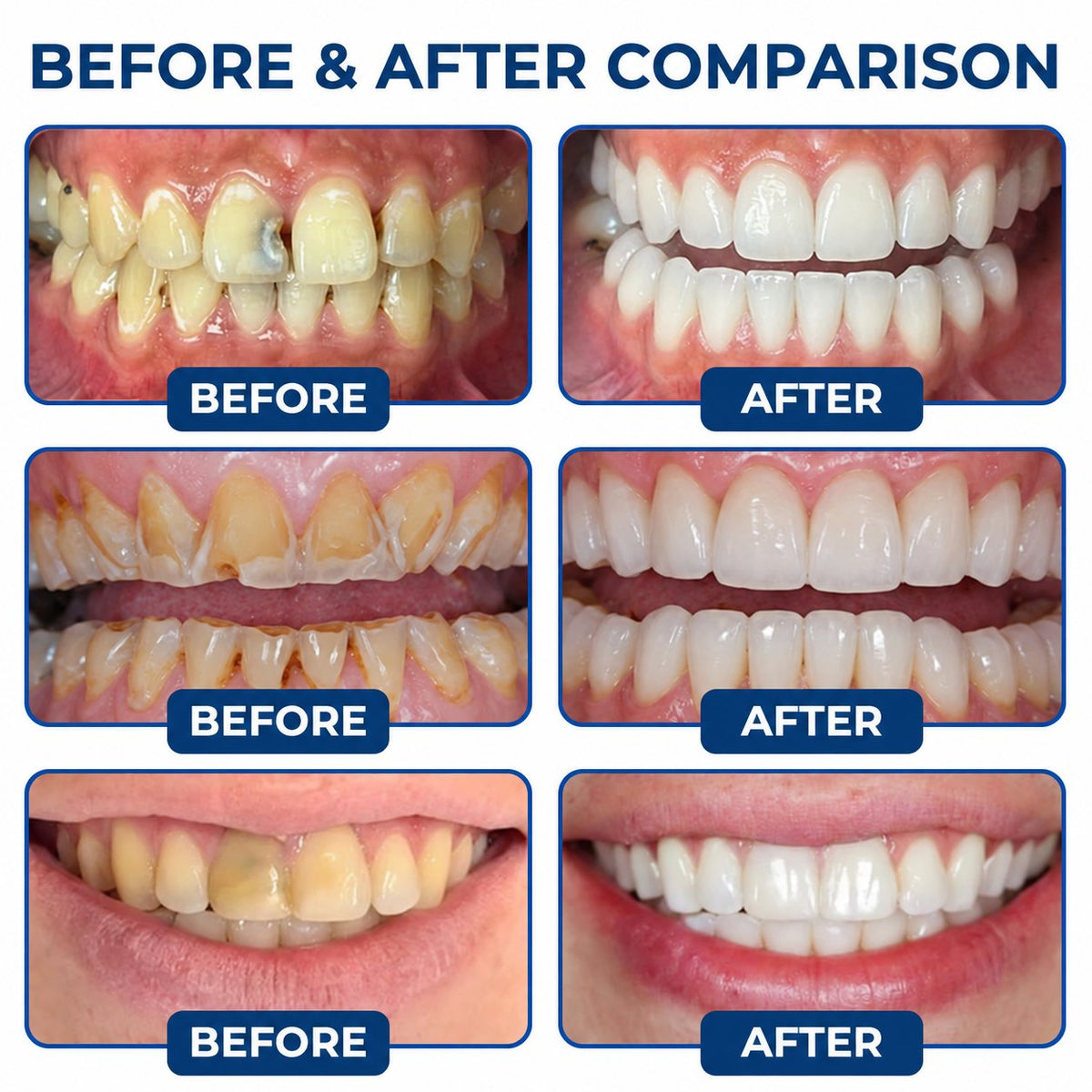 Dr.Fachmer® DentRestore Tooth Repair & Filling System 🌼